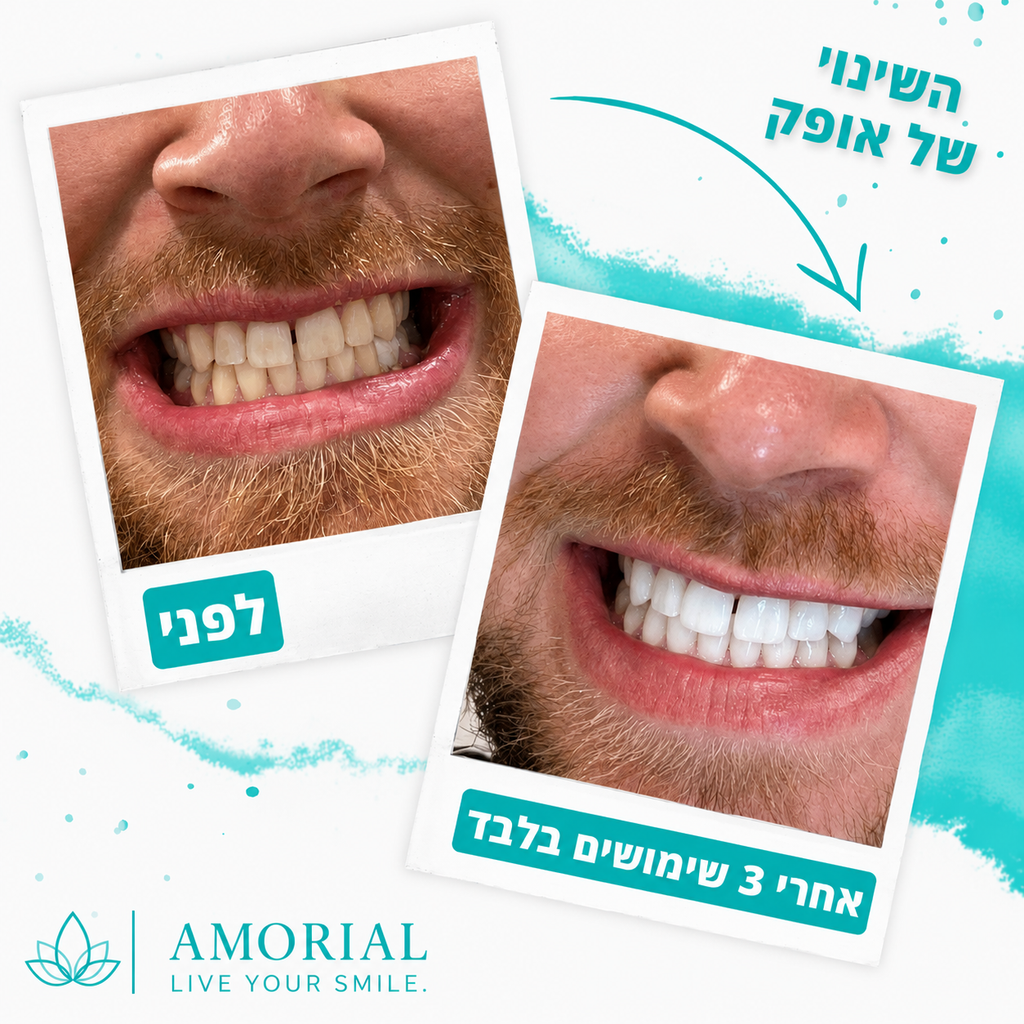 מארז ההלבנה הטבעי™ | AMORIAL