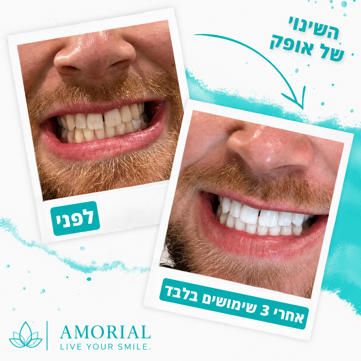 מארז ההלבנה הטבעי™ | AMORIAL