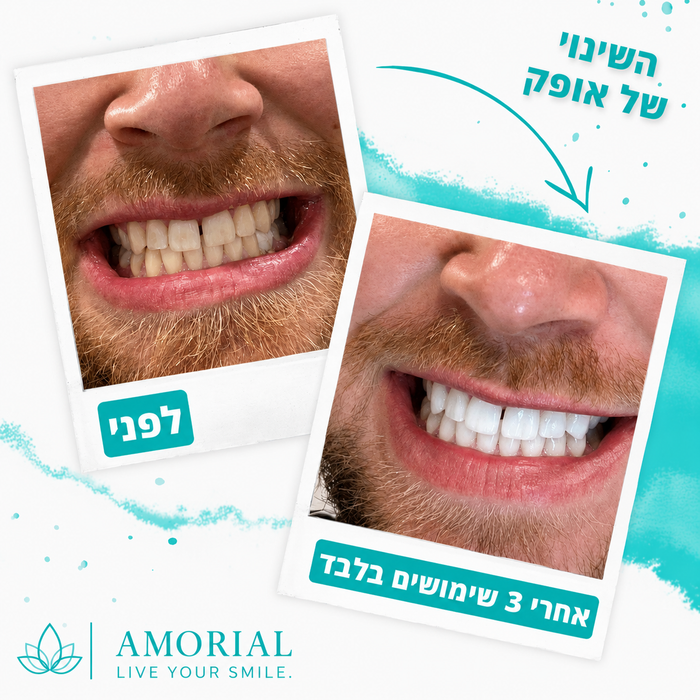 ליפני ואחרי