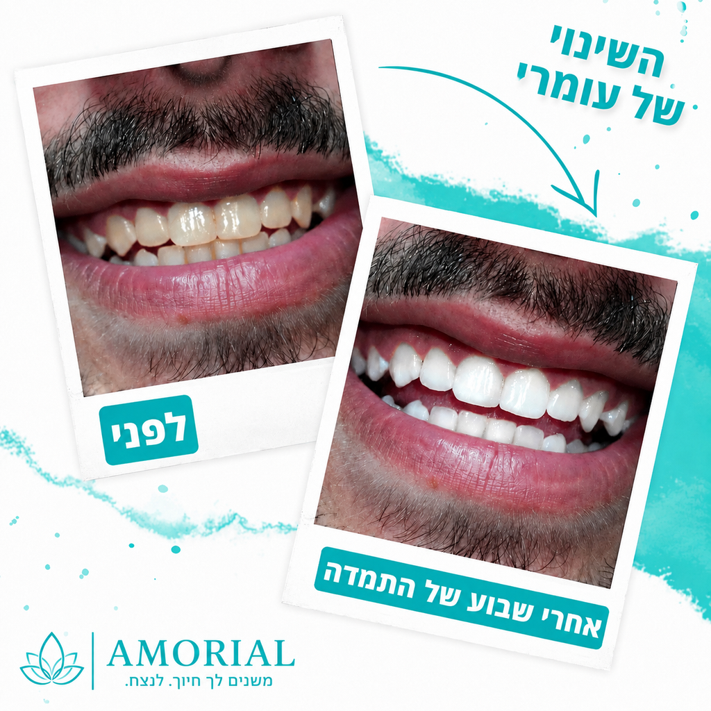 מארז ההלבנה הטבעי™ | AMORIAL